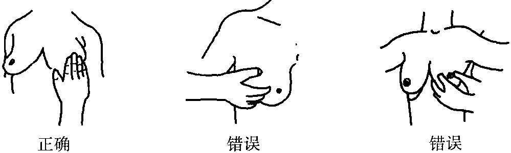 一、乳腺自我檢查